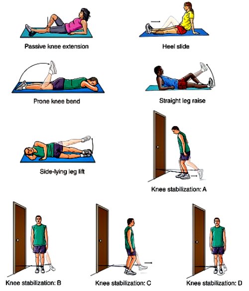 MCL Sprain Exercises - Mobility, Strengthening & Sports Specific