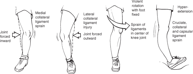 common soccer injuries, common soccer foot injuries, common injuries in soccer players